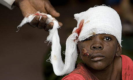 Haiti_crianca_ferida